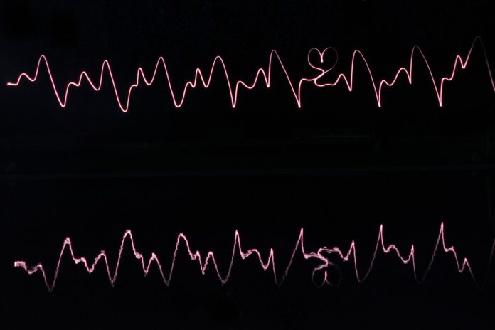 Expert insights on the growth and size of the vibration monitoring industry